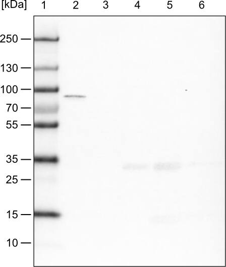 CARS Antibody (CL2302) - Azide and BSA Free Western Blot: CARS Antibody [NBP3-44480]