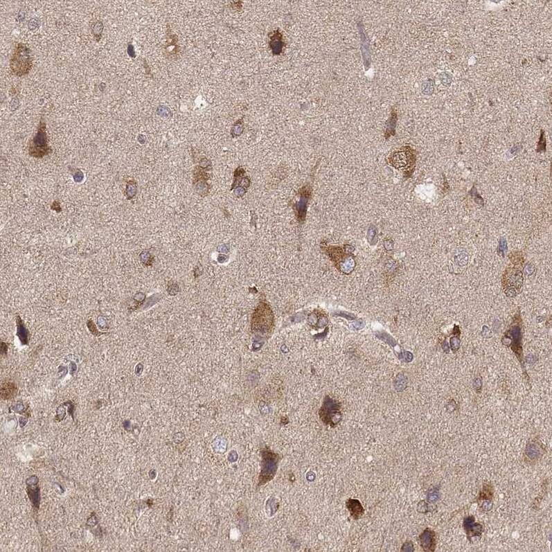 CARS Antibody (CL2302) - Azide and BSA Free Immunohistochemistry-Paraffin: CARS Antibody [NBP3-44480]