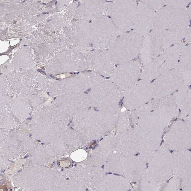 CARS Antibody (CL2302) - Azide and BSA Free Immunohistochemistry-Paraffin: CARS Antibody [NBP3-44480]