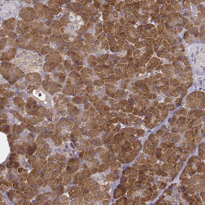 CARS Antibody (CL2302) - Azide and BSA Free Immunohistochemistry-Paraffin: CARS Antibody [NBP3-44480]