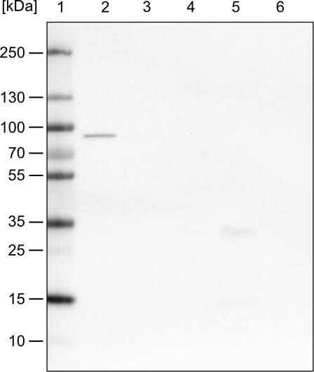 CARS Antibody (CL2304) - Azide and BSA Free Western Blot: CARS Antibody [NBP3-44481]