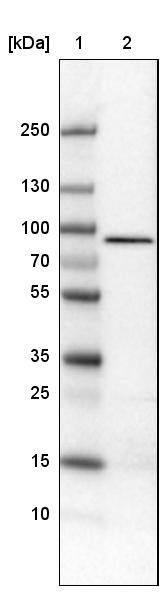 CARS Antibody (CL2304) - Azide and BSA Free Western Blot: CARS Antibody [NBP3-44481]