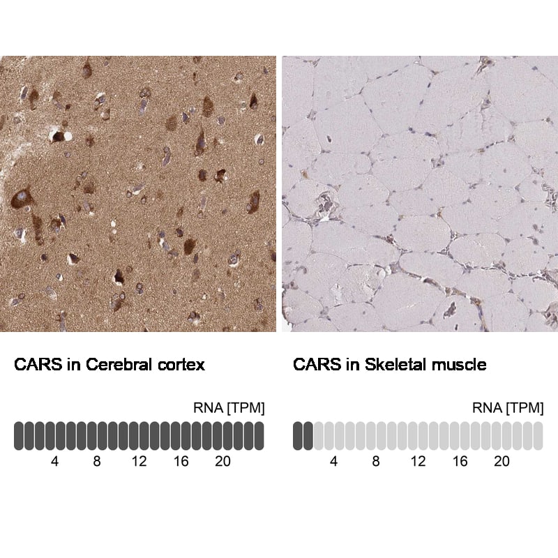CARS Antibody (CL2304) - Azide and BSA Free Immunohistochemistry-Paraffin: CARS Antibody [NBP3-44481]