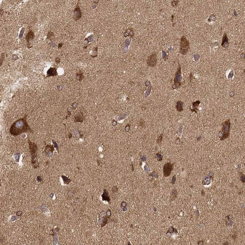 CARS Antibody (CL2304) - Azide and BSA Free Immunohistochemistry-Paraffin: CARS Antibody [NBP3-44481]