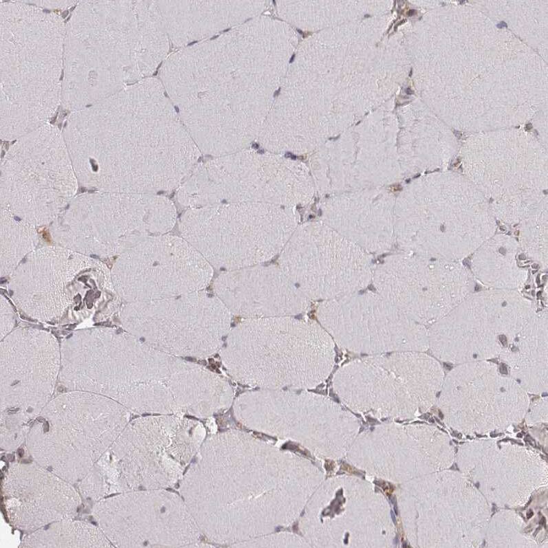 CARS Antibody (CL2304) - Azide and BSA Free Immunohistochemistry-Paraffin: CARS Antibody [NBP3-44481]