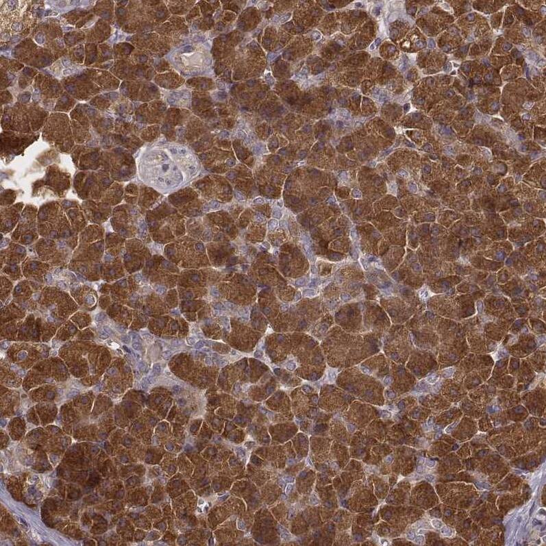 CARS Antibody (CL2304) - Azide and BSA Free Immunohistochemistry-Paraffin: CARS Antibody [NBP3-44481]