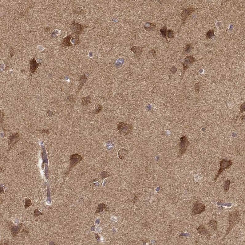 CARS Antibody (CL2309) - Azide and BSA Free Immunohistochemistry-Paraffin: CARS Antibody [NBP3-44482]