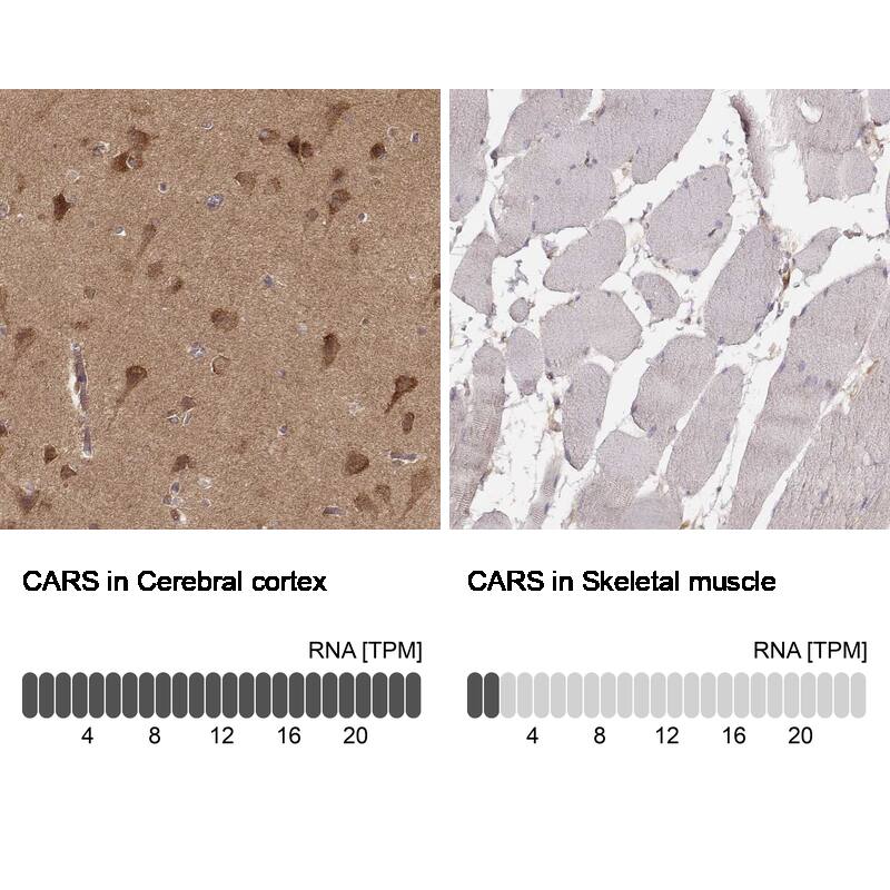 CARS Antibody (CL2309) - Azide and BSA Free Immunohistochemistry-Paraffin: CARS Antibody [NBP3-44482]