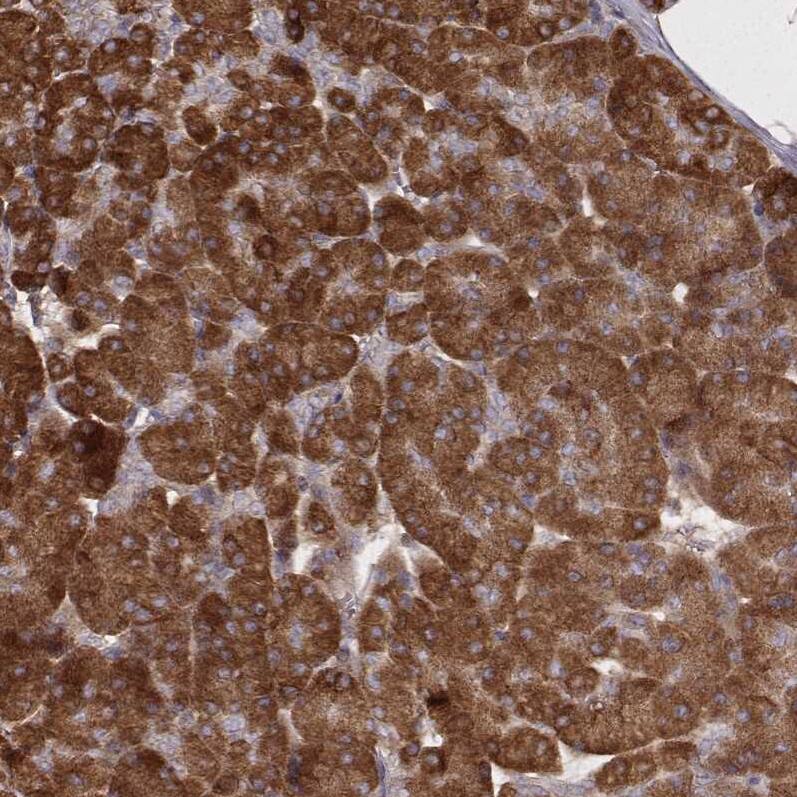 CARS Antibody (CL2309) - Azide and BSA Free Immunohistochemistry-Paraffin: CARS Antibody [NBP3-44482]
