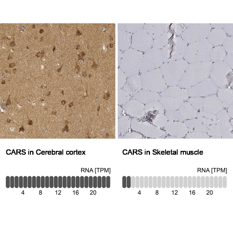 CARS Antibody (CL2310) - Azide and BSA Free Immunohistochemistry-Paraffin: CARS Antibody [NBP3-44483]