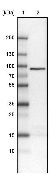 CARS Antibody (CL2310) - Azide and BSA Free Western Blot: CARS Antibody [NBP3-44483]