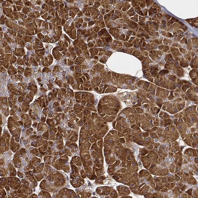 CARS Antibody (CL2310) - Azide and BSA Free Immunohistochemistry-Paraffin: CARS Antibody [NBP3-44483]