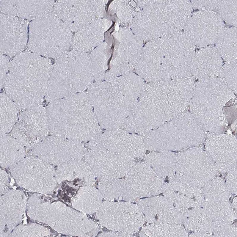 CARS Antibody (CL2310) - Azide and BSA Free Immunohistochemistry-Paraffin: CARS Antibody [NBP3-44483]