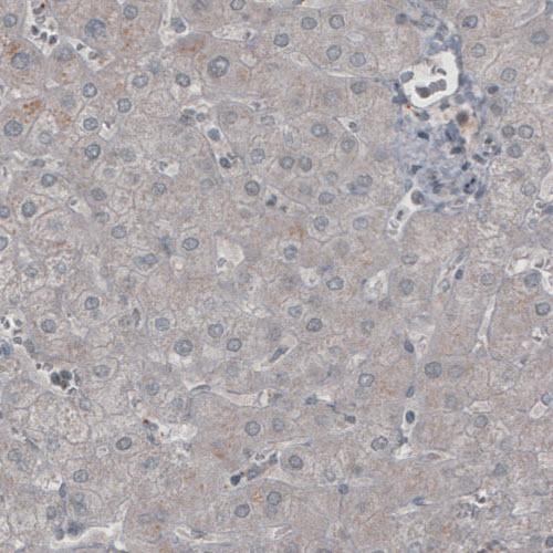 Ly6K Antibody (CL2435) - Azide and BSA Free Immunohistochemistry-Paraffin: Ly6K Antibody [NBP3-44485]
