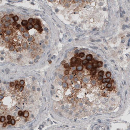 Ly6K Antibody (CL2435) - Azide and BSA Free Immunohistochemistry-Paraffin: Ly6K Antibody [NBP3-44485]