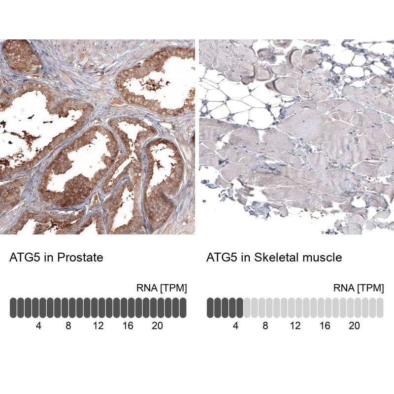 ATG5 Antibody (CL9508) - Azide and BSA Free Immunohistochemistry-Paraffin: ATG5 Antibody [NBP3-44486]