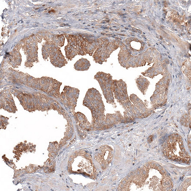 ATG5 Antibody (CL9508) - Azide and BSA Free Immunohistochemistry-Paraffin: ATG5 Antibody [NBP3-44486]