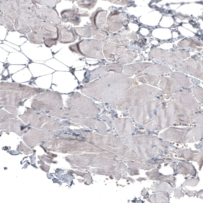 ATG5 Antibody (CL9508) - Azide and BSA Free Immunohistochemistry-Paraffin: ATG5 Antibody [NBP3-44486]