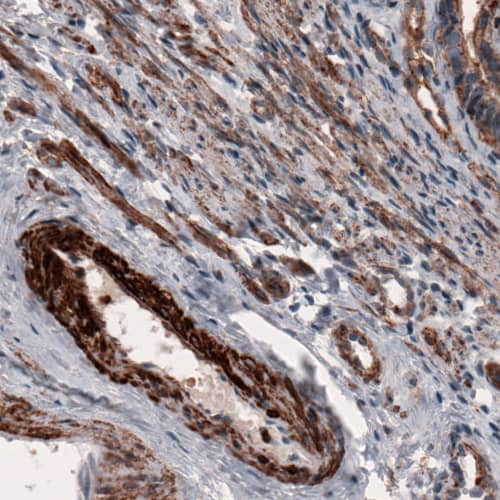 beta-Actin Antibody (CL3868) - Azide and BSA Free Immunohistochemistry-Paraffin: beta-Actin Antibody [NBP3-44487]