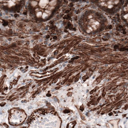 beta-Actin Antibody (CL3868) - Azide and BSA Free Immunohistochemistry-Paraffin: beta-Actin Antibody [NBP3-44487]