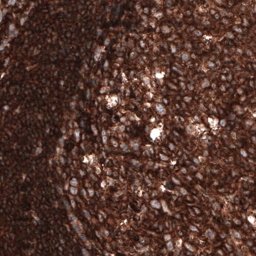 beta-Actin Antibody (CL3868) - Azide and BSA Free Immunohistochemistry-Paraffin: beta-Actin Antibody [NBP3-44487]