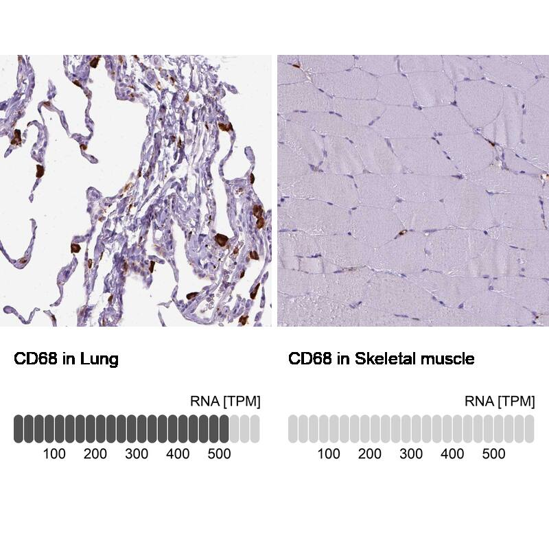 CD68/SR-D1 Antibody (CL1346) - Azide and BSA Free Immunohistochemistry-Paraffin: CD68/SR-D1 Antibody [NBP3-44491]