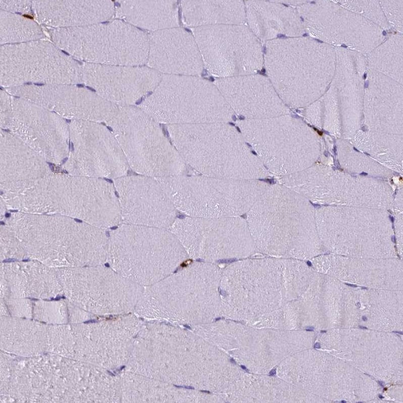 CD68/SR-D1 Antibody (CL1346) - Azide and BSA Free Immunohistochemistry-Paraffin: CD68/SR-D1 Antibody [NBP3-44491]
