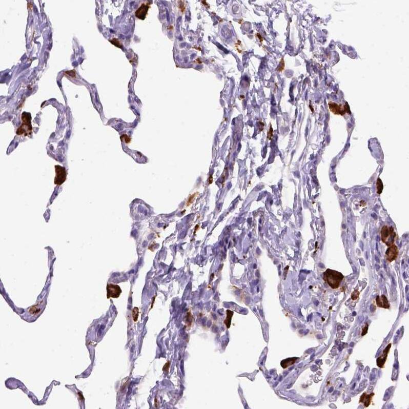 CD68/SR-D1 Antibody (CL1346) - Azide and BSA Free Immunohistochemistry-Paraffin: CD68/SR-D1 Antibody [NBP3-44491]