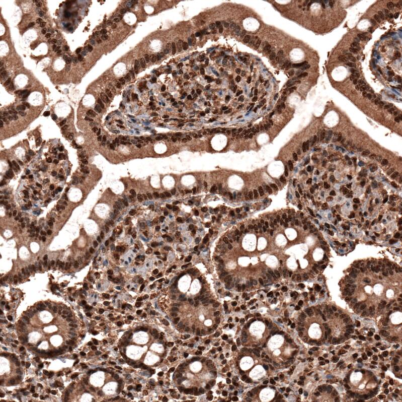 GAPDH Antibody (CL3266) - Azide and BSA Free Immunohistochemistry-Paraffin: GAPDH Antibody [NBP3-44492]