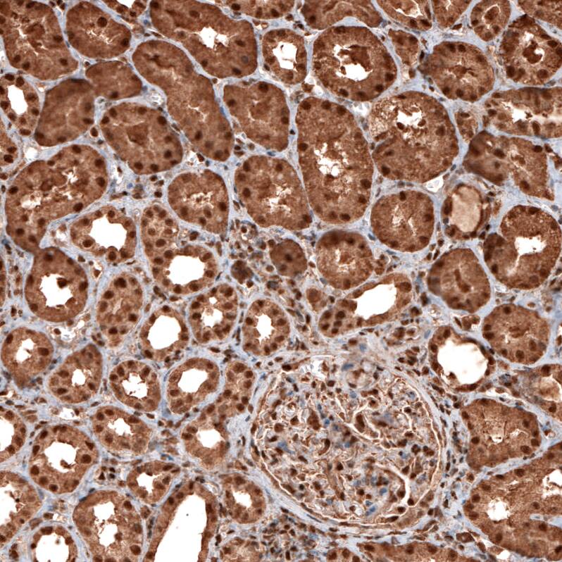 GAPDH Antibody (CL3266) - Azide and BSA Free Immunohistochemistry-Paraffin: GAPDH Antibody [NBP3-44492]