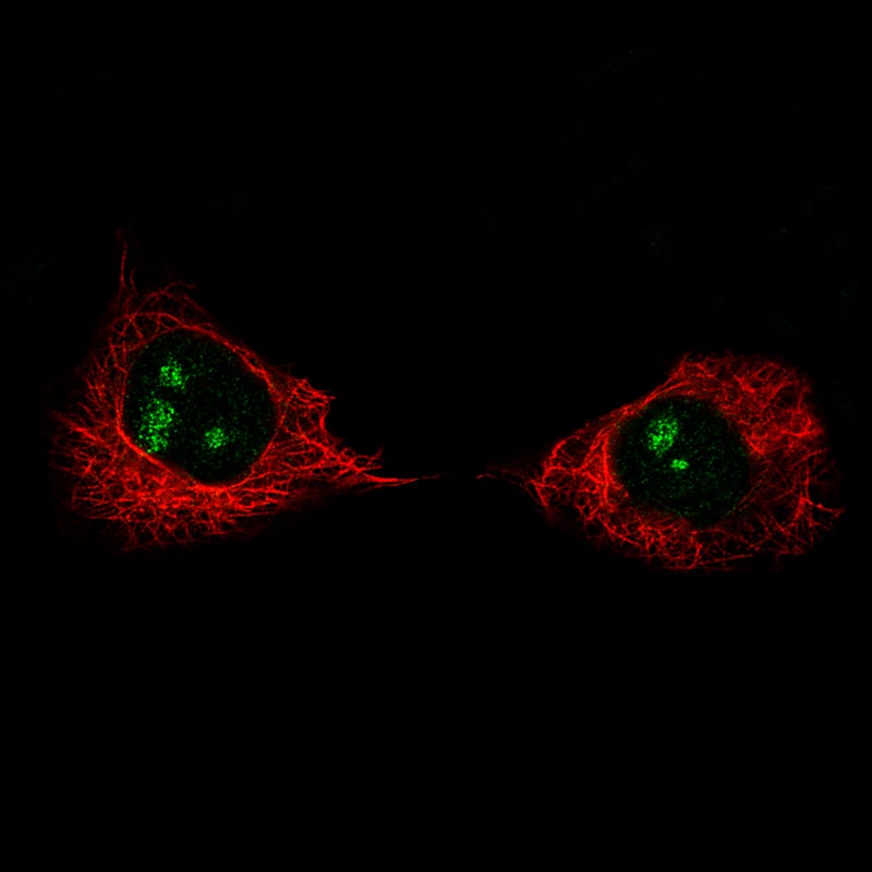 Ki67/MKI67 Antibody (CL1234) - Azide and BSA Free Immunocytochemistry/ Immunofluorescence: Ki67/MKI67 Antibody [NBP3-44494]