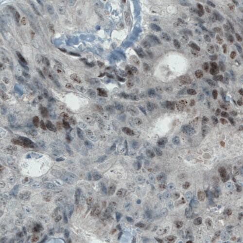 Ki67/MKI67 Antibody (CL1234) - Azide and BSA Free Immunohistochemistry-Paraffin: Ki67/MKI67 Antibody [NBP3-44494]