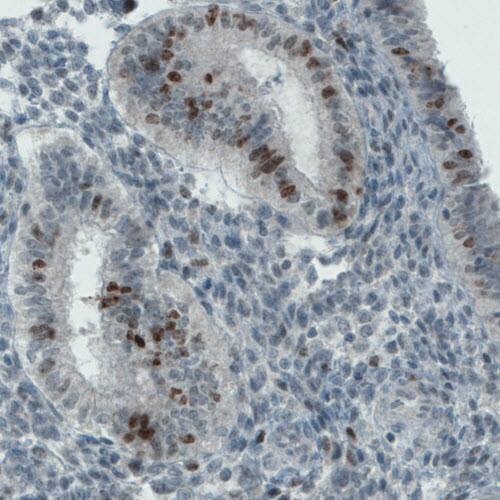 Ki67/MKI67 Antibody (CL1234) - Azide and BSA Free Immunohistochemistry-Paraffin: Ki67/MKI67 Antibody [NBP3-44494]