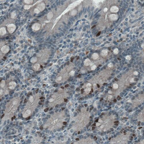 Ki67/MKI67 Antibody (CL1234) - Azide and BSA Free Immunohistochemistry-Paraffin: Ki67/MKI67 Antibody [NBP3-44494]