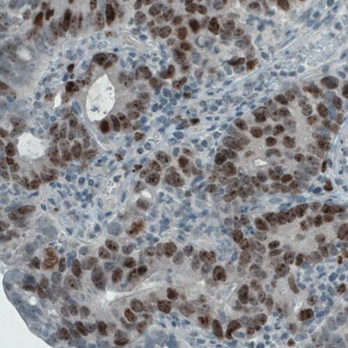 Ki67/MKI67 Antibody (CL1234) - Azide and BSA Free Immunohistochemistry-Paraffin: Ki67/MKI67 Antibody [NBP3-44494]