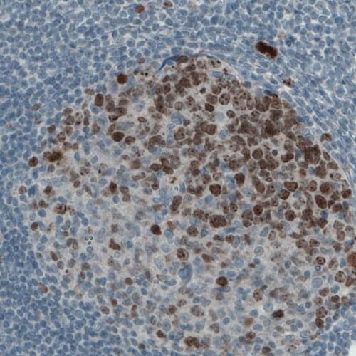 Ki67/MKI67 Antibody (CL1234) - Azide and BSA Free Immunohistochemistry-Paraffin: Ki67/MKI67 Antibody [NBP3-44494]