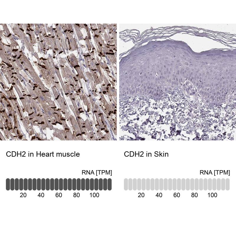 N-Cadherin Antibody (CL3716) - Azide and BSA Free Immunohistochemistry-Paraffin: N-Cadherin Antibody [NBP3-44495]