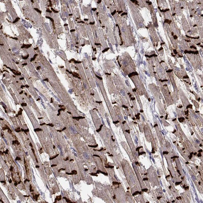 N-Cadherin Antibody (CL3716) - Azide and BSA Free Immunohistochemistry-Paraffin: N-Cadherin Antibody [NBP3-44495]