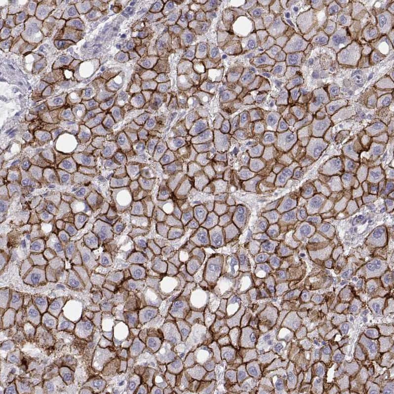 N-Cadherin Antibody (CL3716) - Azide and BSA Free Immunohistochemistry-Paraffin: N-Cadherin Antibody [NBP3-44495]