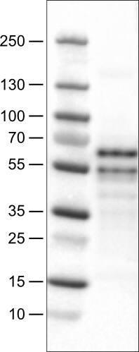 RUNX2/CBFA1 Antibody (CL0232) - Azide and BSA Free Western Blot: RUNX2/CBFA1 Antibody [NBP3-44496]