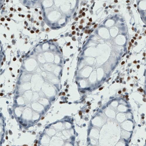RUNX2/CBFA1 Antibody (CL0232) - Azide and BSA Free Immunohistochemistry-Paraffin: RUNX2/CBFA1 Antibody [NBP3-44496]
