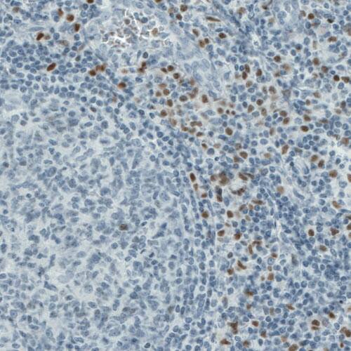 RUNX2/CBFA1 Antibody (CL0232) - Azide and BSA Free Immunohistochemistry-Paraffin: RUNX2/CBFA1 Antibody [NBP3-44496]