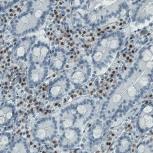 RUNX2/CBFA1 Antibody (CL0232) - Azide and BSA Free Immunohistochemistry-Paraffin: RUNX2/CBFA1 Antibody [NBP3-44496]