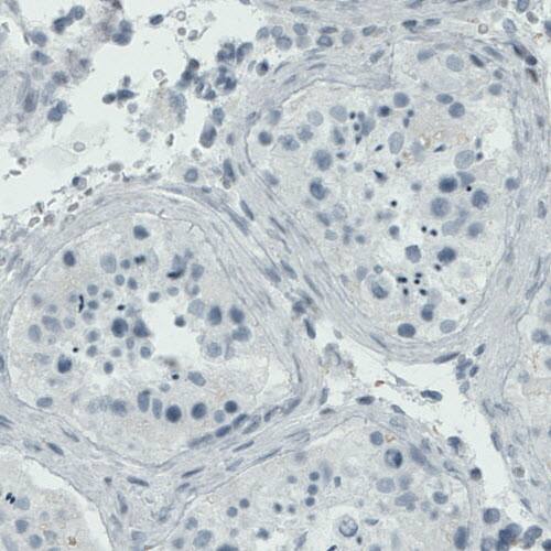 RUNX2/CBFA1 Antibody (CL0232) - Azide and BSA Free Immunohistochemistry-Paraffin: RUNX2/CBFA1 Antibody [NBP3-44496]