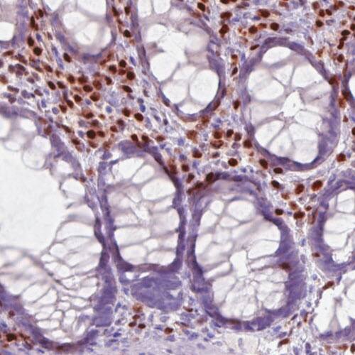 RUNX2/CBFA1 Antibody (CL0235) - Azide and BSA Free Immunohistochemistry-Paraffin: RUNX2/CBFA1 Antibody [NBP3-44497]