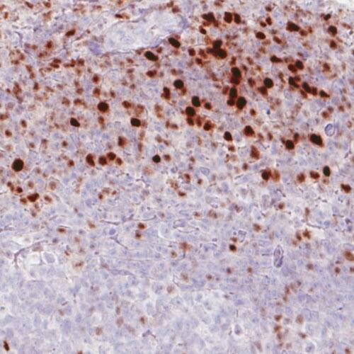 RUNX2/CBFA1 Antibody (CL0235) - Azide and BSA Free Immunohistochemistry-Paraffin: RUNX2/CBFA1 Antibody [NBP3-44497]