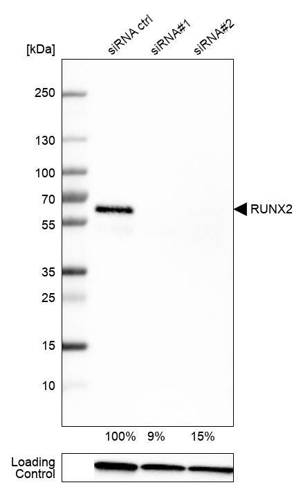 RUNX2/CBFA1 Antibody (CL0235) - Azide and BSA Free Western Blot: RUNX2/CBFA1 Antibody [NBP3-44497]