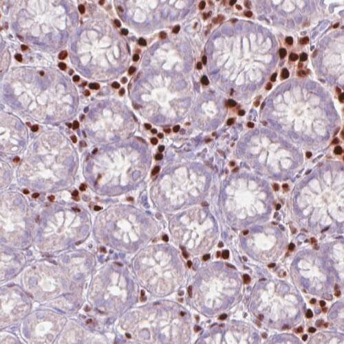 RUNX2/CBFA1 Antibody (CL0235) - Azide and BSA Free Immunohistochemistry-Paraffin: RUNX2/CBFA1 Antibody [NBP3-44497]