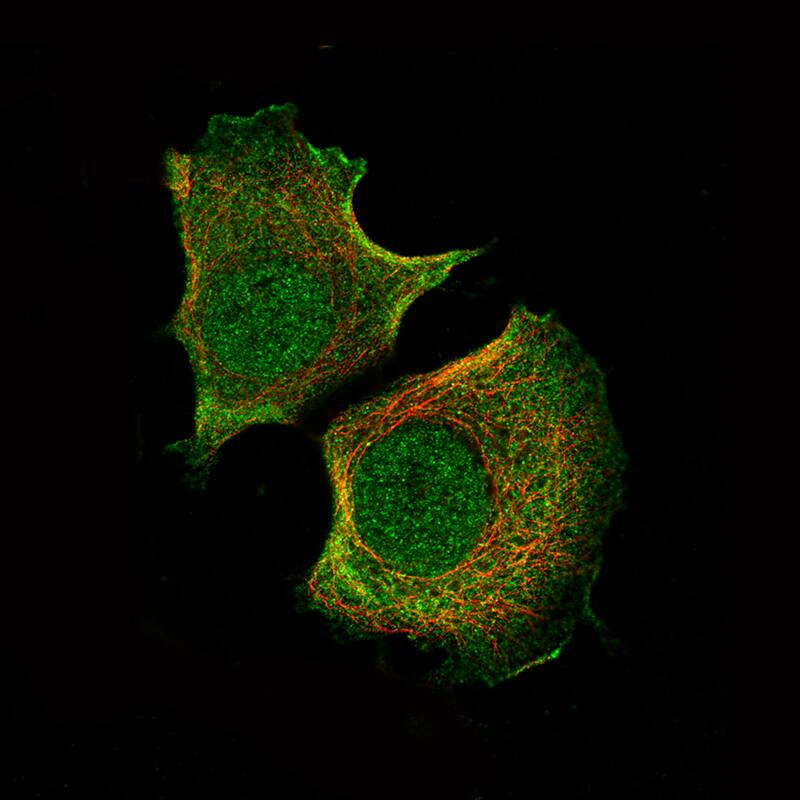 AKT1 Antibody (CL0887) - Azide and BSA Free Immunocytochemistry/ Immunofluorescence: AKT1 Antibody [NBP3-44500]
