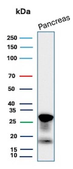 ELA3A Antibody (CELA3A/12552)